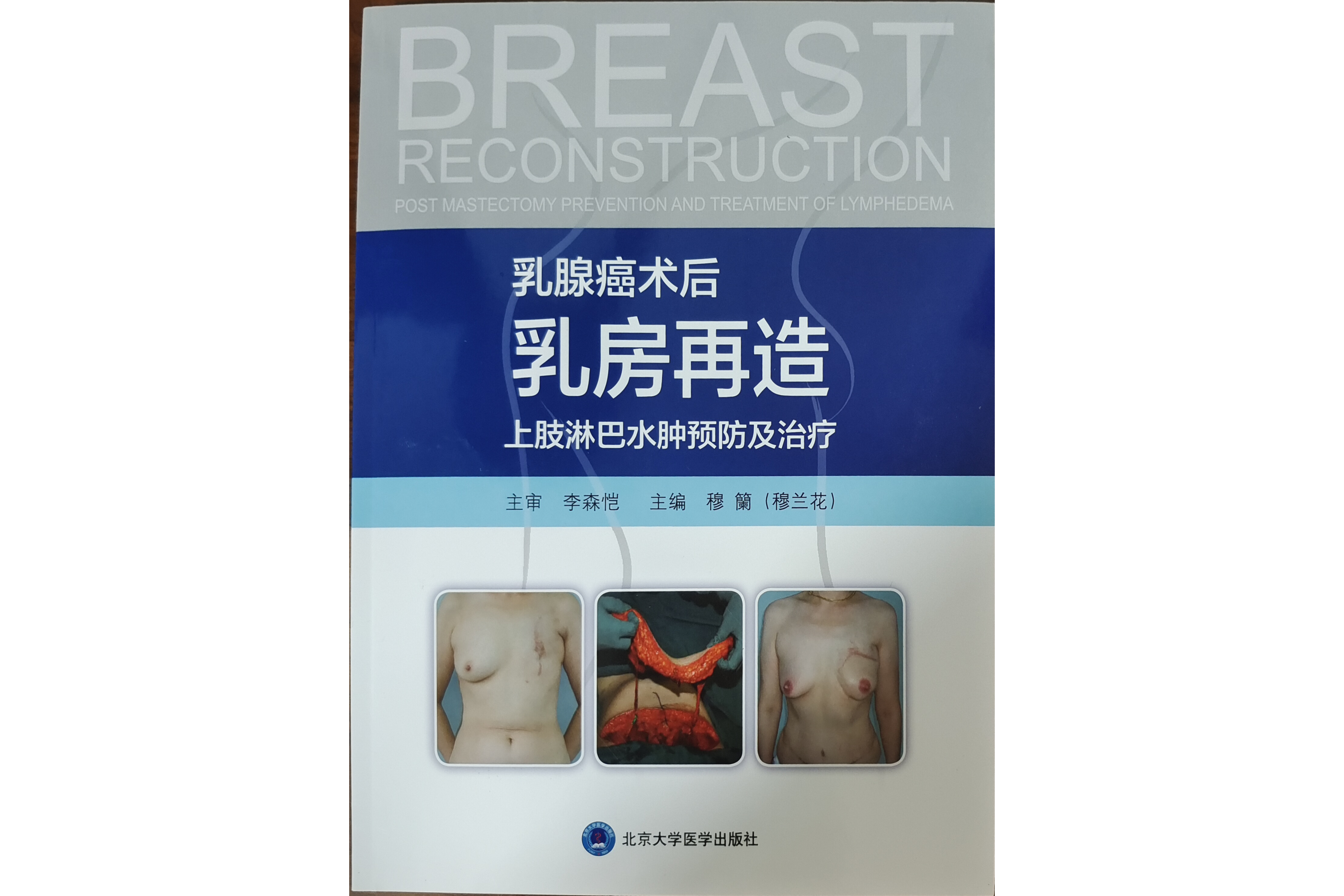 《乳腺癌术后乳房再造上肢淋巴结水肿预防机治疗》.jpg